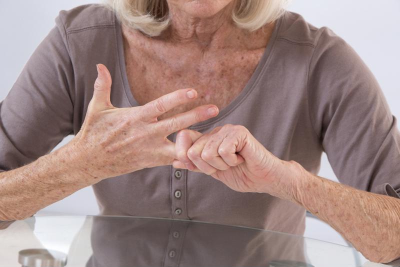Woman with arthritis in hands stretching fingers 